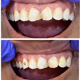 before-after-small-1 