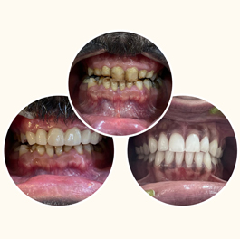before-after-small-1 